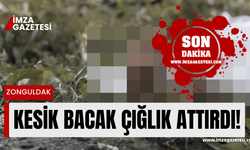 Zonguldak'ta kesik bacak korkuttu!