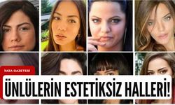 Ünlülerin estetiksiz halleri!