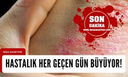 Sedef Hastalarının Psiko-Sosyal Yükü Her Geçen Gün Büyüyor...