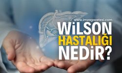 Wilson Hastalığı Nedir? Belirtileri ve Tedavi Yöntemleri