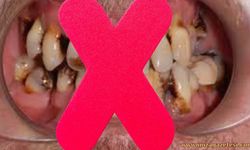 Dişlerini Fırçalamayan Diktatör Kimdir?