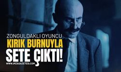 Zonguldaklı Oyuncu Kırık Burnuyla Sete Çıktı!