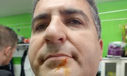 Zonguldak'ta Maç Sonrası Kavga! Polisler ve Gazeteciler Yaralandı!