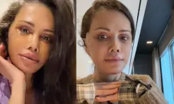 Didem Ceran neden yüz nakli oldu?