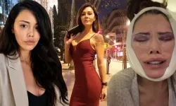 Didem Ceran Neden Yüz Nakli Yaptırdı? Nerede Yaptırdı?