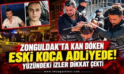 Zonguldak'ta Kan Döken Eski Koca Adliyede! Yüzündeki İzler Dikkat Çekti
