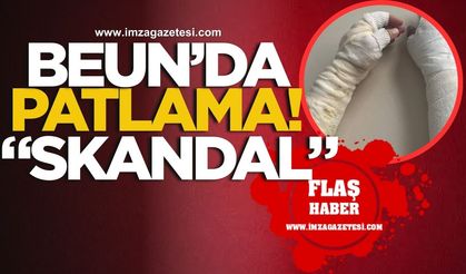 BEUN’da patlama! Skandal güvenlik zafiyeti can yaktı!