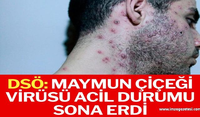 DSÖ: Maymun çiçeği virüsü acil durumu sona erdi…