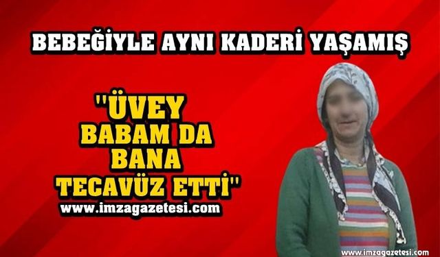 BEBEĞİYLE AYNI KADERİ YAŞAMIŞ!