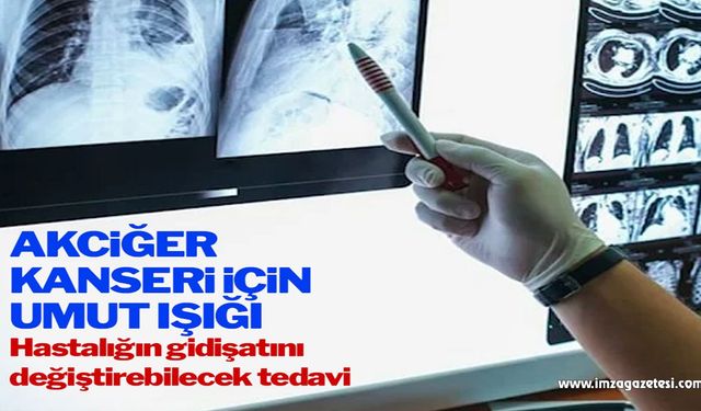 Akciğer kanseri için umut ışığı: Hastalığın gidişatı değişebilir!..