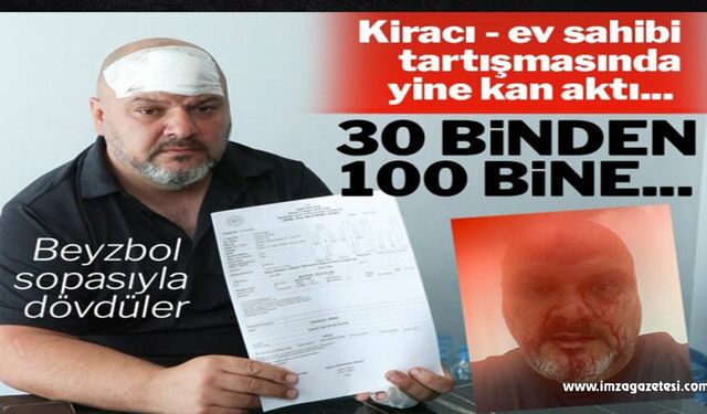 Kiracı ev sahibi tartışmasında yine kan aktı!..