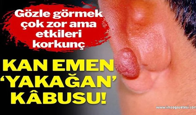 Kan emen ‘yakağan’ kâbusu! Gözle görmek çok zor ama etkileri korkunç!..