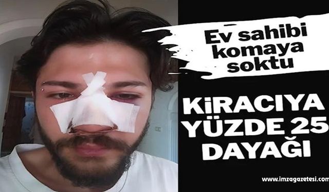 Kiracıya ev sahibinden yüzde 25 dayağı!..