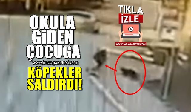 Okula giden çocuğa 2 köpek böyle saldırdı!