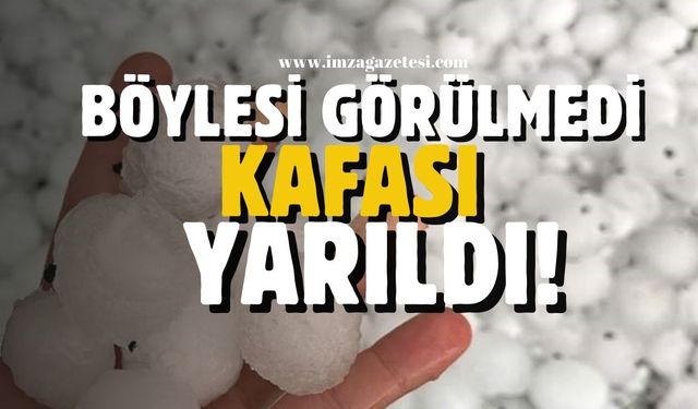 Böylesi görülmedi...Dolu kafasını yardı!