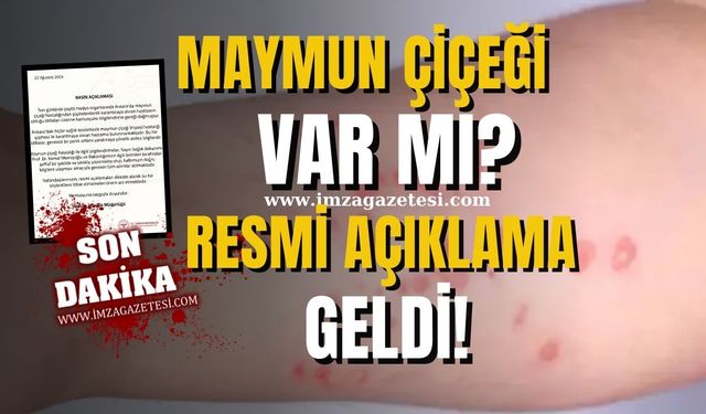 Maymun Çiçeği İddialarına Resmi Yanıt Geldi!