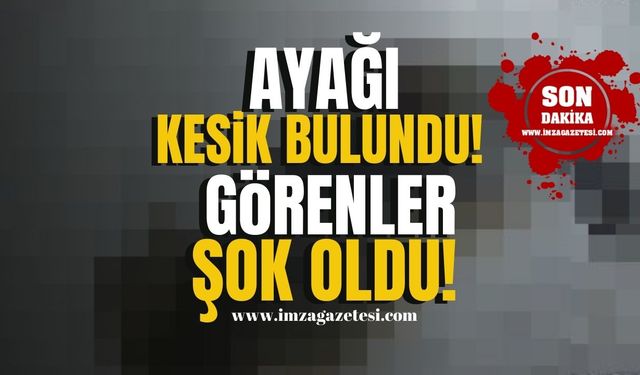 Zonguldak'ta şok olay! Ayağı kesik bulundu!