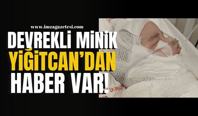 Devrek’te yanan 6 Aylık Yiğitcan’dan haber var! | Devrek Haber