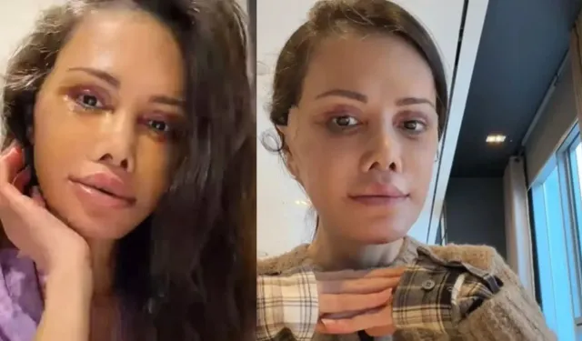 Didem Ceran neden yüz nakli oldu?
