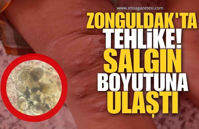 Zonguldak’ta Tehlike! Salgın Boyutuna Ulaştı!