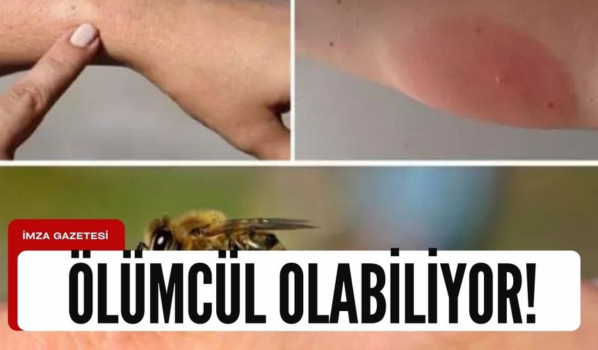Arı alerjisi deyip geçmeyin!