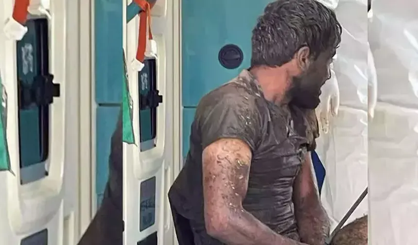 Bol basınçlı suyla ve sabunla yaranın yıkanması gerektiğinin altını çizen Aydemir, "Kuduz viral bir enfeksiyon hastalığı. Esas olarak hayvanlardan insanlara bulaşmakta. Ölümcül oranı gerçekten çok yüksek bir enfeksiyon hastalığı. Ancak kuduz şüpheli temas sonrasında doğru yapılan, önlem basamaklarıyla yüzde yüz önlenebilir bir enfeksiyon hastalığı. En çok açıkçası ülkemin için söylüyorum. Daha çok köpek ısırıklarıyla bulaşmakta bu hastalık. Kuduz şüpheli herhangi bir temasta ilk yapılacak basamak yaralanma bölgesinin doğru bir şekilde temizliği. Çünkü bu temizlik aşamasıyla virüs bu bölgeden yüzde doksan dokuz oranında temizlenmiş olacak ve aslında önlem basamaklarının en önemlisini oluşturmakta. Hani nasıl önlemini yapacağız? Bol basınçlı, suyla, sabunla, düzgün bir şekilde bu bölgeyi yıkamak ve yıkadıktan sonra da antiseptik solüsyonlar uygulanmasıyla lezyon bölgesinin koruması ilk etapta yapılmış oluyor" diye konuştu.