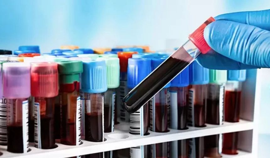 Parkinson’a Erken Tanı İçin Devrim Niteliğinde Kan Testi