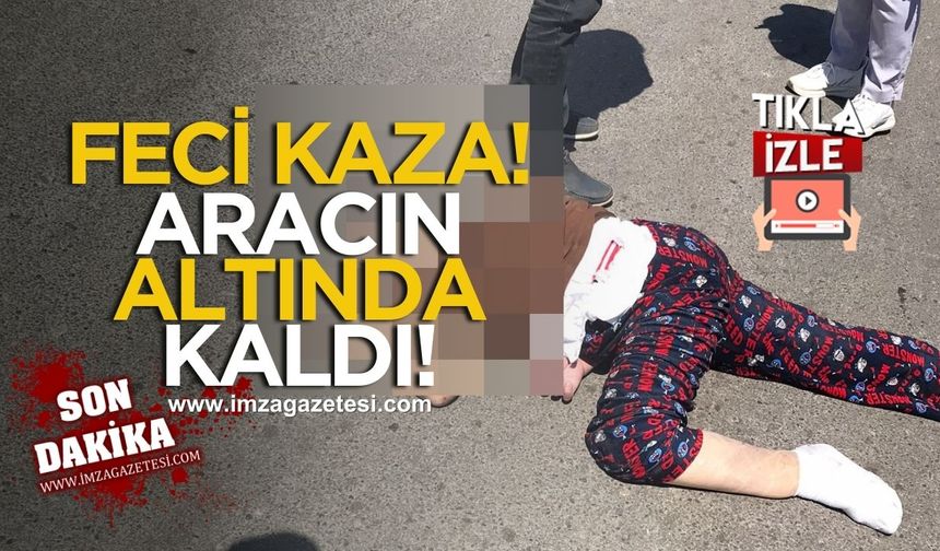 Zonguldak’ta Nakliyat Aracı Yaşlı Kadına Çarptı!