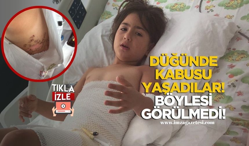 Düğünde kabusu yaşadılar! 8 yaşındaki Elif yandı!