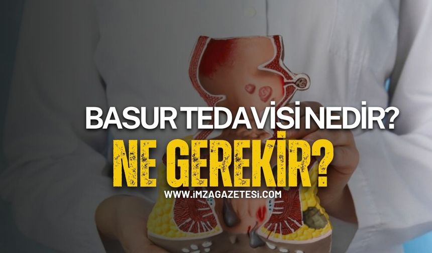Basur Tedavisi Nedir? Neden Gerekir?