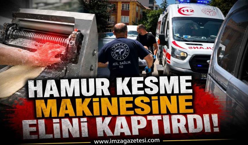 Hamur Kesme Makinesine Elini Kaptırdı!
