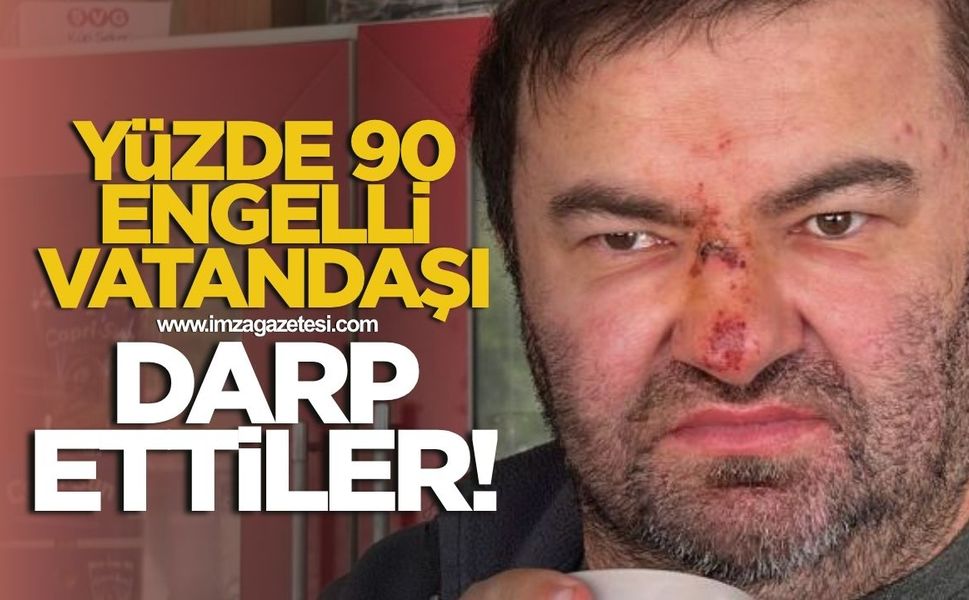 Yüzde 90 engelli vatandaşı darp ettiler