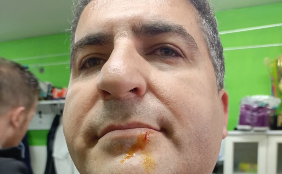 Zonguldak'ta Maç Sonrası Kavga! Polisler ve Gazeteciler Yaralandı!