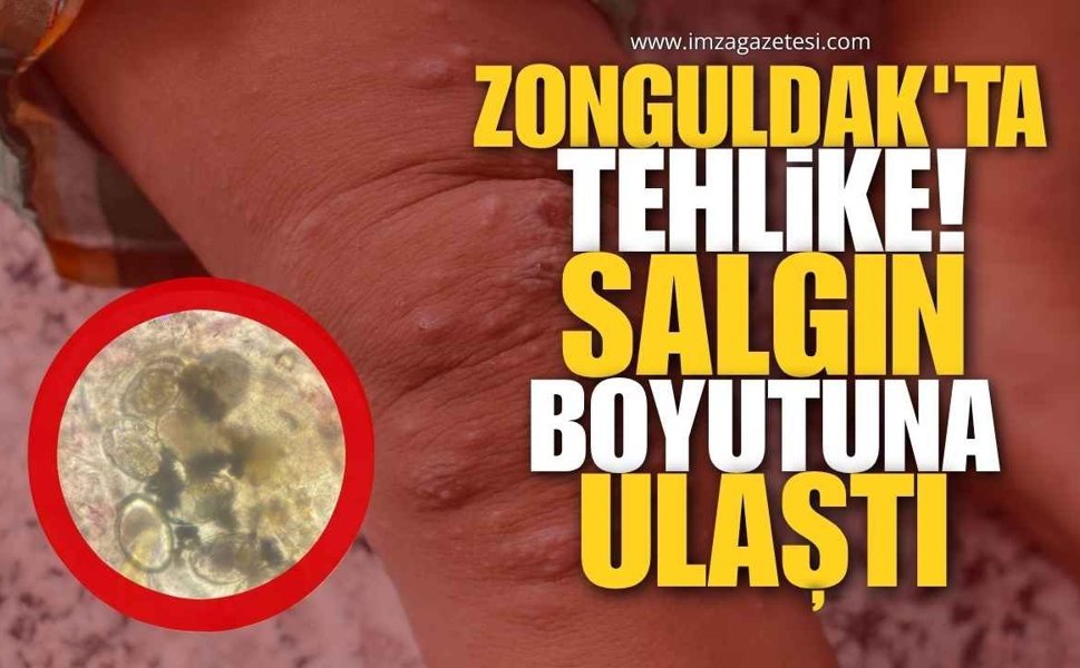 Zonguldak’ta Tehlike! Salgın Boyutuna Ulaştı!