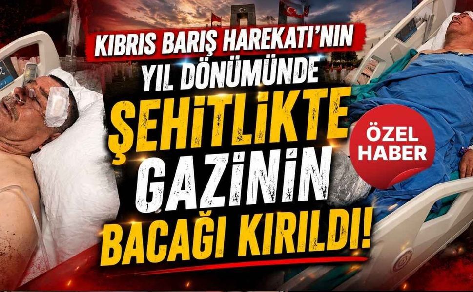 Kıbrıs Barış Harekatı’nın Yıl Dönümünde Şehitlikte Gazinin Bacağı Kırıldı!