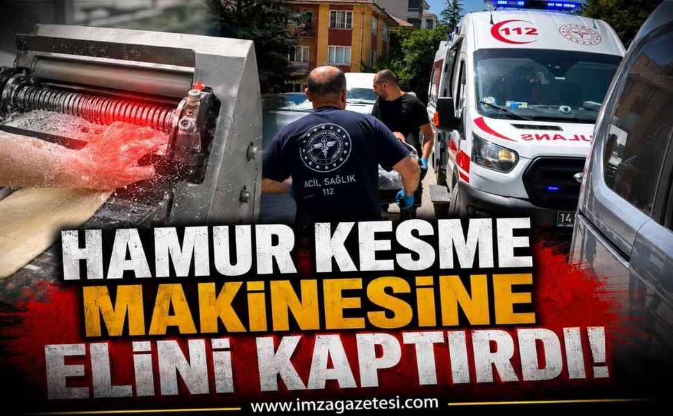 Hamur Kesme Makinesine Elini Kaptırdı!