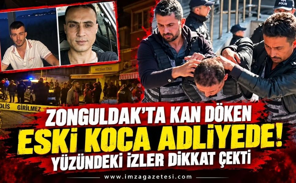 Zonguldak'ta Kan Döken Eski Koca Adliyede! Yüzündeki İzler Dikkat Çekti