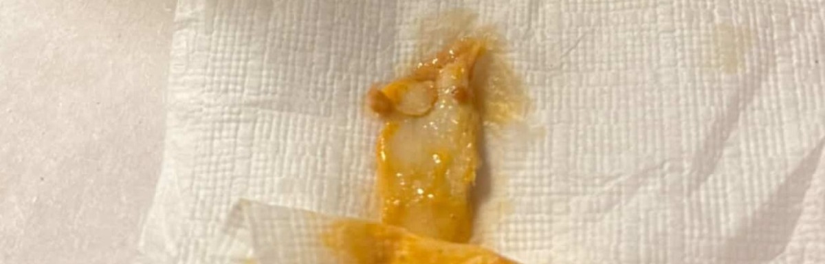 Zonguldak'ta Mi̇de Bulandiran Görüntü! Imza Gazetesi (2)