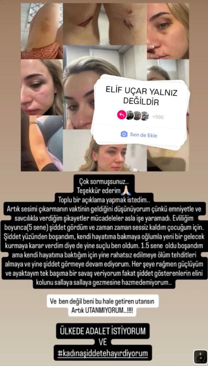 Elif Öğretmenin Çığlığı Sosyal Medyayı Salladı! Ölüm Tehditleri Alıyorum, Saldırgan Serbest! İmza Gazetesi̇ (1)