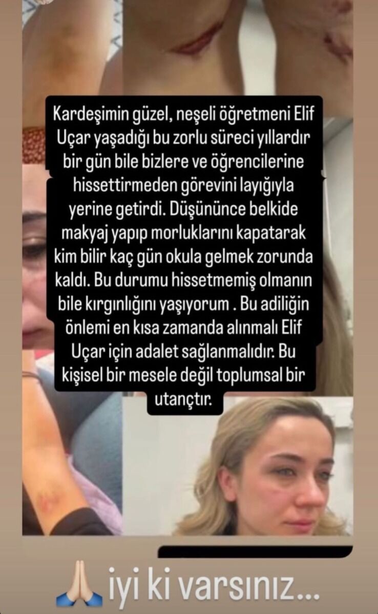 Elif Öğretmenin Çığlığı Sosyal Medyayı Salladı! Ölüm Tehditleri Alıyorum, Saldırgan Serbest! İmza Gazetesi̇ (2)