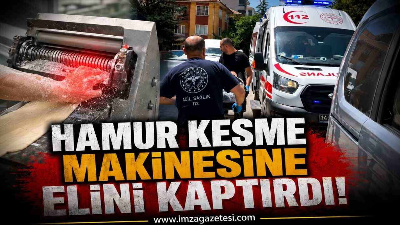 Hamur Kesme Makinesine Elini Kaptırdı!