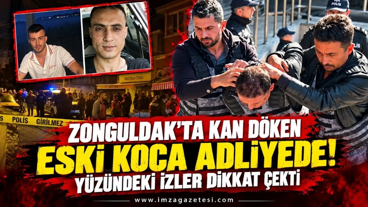 Zonguldak'ta Kan Döken Eski Koca Adliyede! Yüzündeki İzler Dikkat Çekti